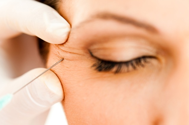 botox Botox is Officially a Cure All: Proven to Help with Acne